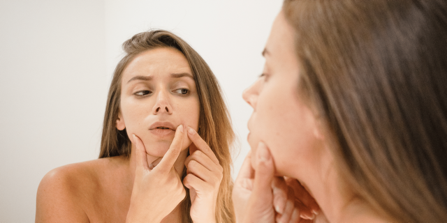 Se débarasser de l'acné hormonale – purpause